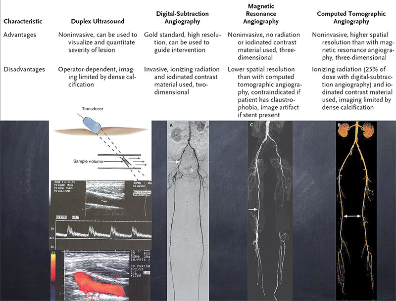 Images of PAD like duplex ultrasound, digital subtraction, magnetic resonance angiography, computed tomographic angiography -limb salvage hawaii